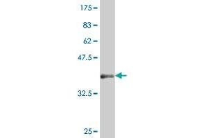 Western Blot detection against Immunogen (37. (HHEX antibody  (AA 133-237))