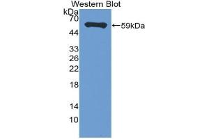 Detection of Recombinant MS4A1, Mouse using Polyclonal Antibody to Membrane Spanning 4 Domains Subfamily A, Member 1 (CD20) (CD20 antibody  (AA 6-251))