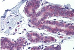 Human Breast (formalin-fixed, paraffin-embedded) stained with LDOC1 antibody ABIN462213 followed by biotinylated goat anti-rabbit IgG secondary antibody ABIN481713, alkaline phosphatase-streptavidin and chromogen. (LDOC1 antibody  (N-Term))