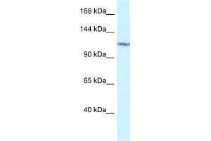 WB Suggested Anti-PKN2 Antibody Titration: 1. (PKN2 antibody  (C-Term))