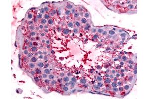 Anti-BEST2 / Bestrophin-2 antibody IHC of human testis. (Bestrophin 2 antibody  (Internal Region))