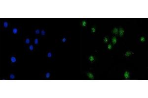 IF analysis of KAT3B/P300/EP300 using anti-KAT3B/P300/EP300 antibody (ABIN7603064).