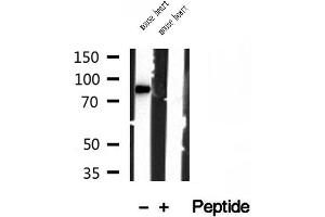 Western blot analysis of extracts of mouse heart tissue, using YME1L1 antibody.
