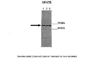 Lanes: Lane 1:241 µg HT 29 lysate blocked with 5 % FBS Lane 2: 041 µg HT 29 lysate blocked with no FBS Lane 3: 041 µg HT-29 lyaste blocked with no PBS + 100 mM NaCl Primary Antibody Dilution: 1:0000Secondary Antibody: Goat anti-rabbit-HRP Secondary Antibody Dilution: 1:0000  Gene Name: NFAT5 Submitted by: Manuel Fresno, CBMSO (NFAT5 antibody  (Middle Region))