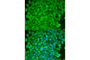 Immunofluorescence analysis of HeLa cells using SGCE antibody (ABIN5973070). (SGCE antibody)