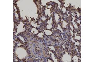 IHC analysis of RAGE/AGER using anti-RAGE/AGER antibody (ABIN7603153).