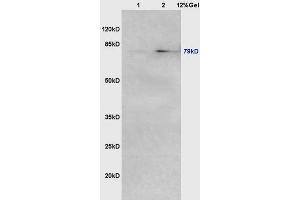 Lane 1: mouse lung lysates Lane 2: mouse intestine lysates probed with Anti VG5Q/AGGF1 Polyclonal Antibody, Unconjugated (ABIN722380) at 1:200 in 4 °C. (AGGF1 antibody  (AA 461-560))
