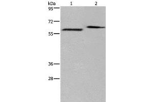 Western Blot analysis of Human fetal brain and Mouse brain tissue using EGR4 Polyclonal Antibody at dilution of 1:400 (EGR4 antibody)