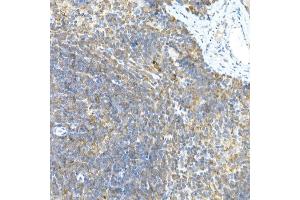 Immunohistochemistry of paraffin-embedded rat brain using LGR5/GPR49 Rabbit pAb  at dilution of 1:300 (40x lens). (LGR5 antibody  (AA 824-907))