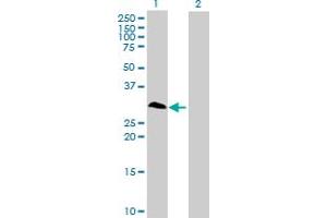 Western Blot analysis of RNF138 expression in transfected 293T cell line by RNF138 MaxPab polyclonal antibody. (RNF138 antibody  (AA 1-245))