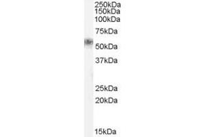 Western Blotting (WB) image for anti-Family with Sequence Similarity 181, Member B (FAM181B) (N-Term) antibody (ABIN2791534) (FAM181B antibody  (N-Term))