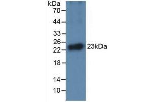 Detection of Recombinant IL1a, Equine using Monoclonal Antibody to Interleukin 1 Alpha (IL1a) (IL1A antibody  (AA 95-269))