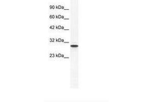 Image no. 1 for anti-Annexin A5 (ANXA5) (AA 71-120) antibody (ABIN202233) (Annexin V antibody  (AA 71-120))
