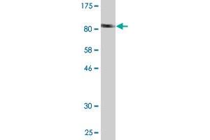 Western Blot detection against Immunogen (94. (TRMT2A antibody  (AA 1-625))