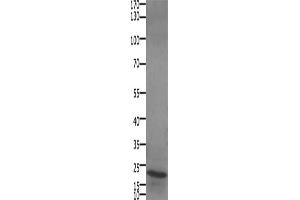 Gel: 10+12 % SDS-PAGE, Lysate: 30 μg, Lane: Human liver cancer tissue, Primary antibody: ABIN7192693(STMN2/STMN3/STMN4 Antibody) at dilution 1/450, Secondary antibody: Goat anti rabbit IgG at 1/8000 dilution, Exposure time: 1 minute (STMN2/STMN3/STMN4 antibody)