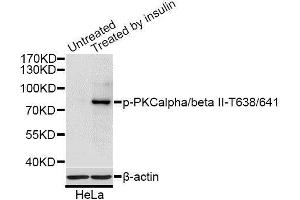 Western blot analysis of extracts of HeLa cells, using Phospho-PRKCB-T641 antibody (ABIN2987563) at 1/1000 dilution. (PKC beta antibody  (pThr641))