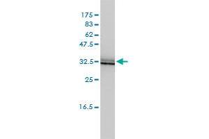 SIGIRR monoclonal antibody (M01A), clone 3H8-2G3 Western Blot analysis of SIGIRR expression in HepG2 . (SIGIRR antibody  (AA 1-410))