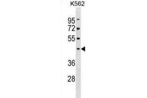 Western Blotting (WB) image for anti-Pellino E3 Ubiquitin Protein Ligase 1 (PELI1) antibody (ABIN3000532) (Pellino 1 antibody)