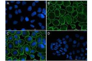 Immunofluorescence Microscopy of Rabbit anti-ZO-1 antibody. (TJP1 antibody)