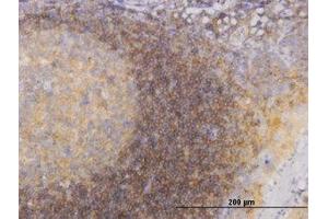 Image no. 3 for anti-Phosphoinositide 3-kinase Regulatory Subunit 4 (PIK3R4) (AA 1259-1359) antibody (ABIN599234) (PIK3R4 antibody  (AA 1259-1359))