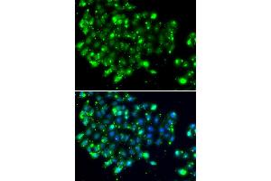 Immunofluorescence analysis of MCF-7 cells using NAT9 antibody (ABIN5974337). (NAT9 antibody)