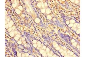 Immunohistochemistry of paraffin-embedded human colon tissue using ABIN7169137 at dilution of 1:100 (PDIK1L antibody  (AA 1-341))