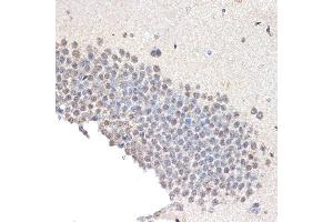 Immunohistochemistry of paraffin-embedded mouse brain using CoREST/RCOR1 Rabbit mAb (ABIN7269920) at dilution of 1:100 (40x lens). (CoREST antibody)