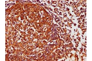IHC image of ABIN7146858 diluted at 1:1000 and staining in paraffin-embedded human lymph node tissue performed on a Leica BondTM system. (Casein Kinase 1 delta antibody  (Isoform delta))