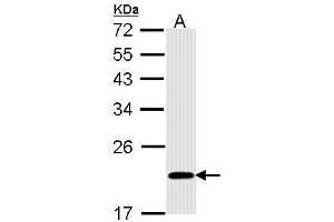 WB Image Sample (30 ug of whole cell lysate) A: A431 , 12% SDS PAGE antibody diluted at 1:1000 (BID antibody)