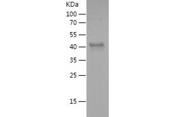 WNT7B Protein (AA 134-349) (His-IF2DI Tag)