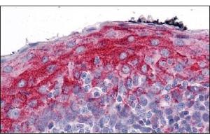 Immunohistochemistry of ZMYM4 in Human Tonsil with ZMYM4 Antibody  at 5 μg/ml. (ZMYM4 antibody  (C-Term))