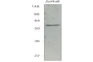 Western Blotting (WB) image for anti-Interferon Regulatory Factor 7 (IRF7) (AA 1-150), (N-Term) antibody (ABIN263914) (IRF7 antibody  (N-Term))