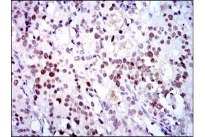 Image no. 2 for anti-Cyclin-Dependent Kinase 2 (CDK2) (AA 197-295) antibody (ABIN1497393) (CDK2 antibody  (AA 197-295))