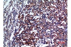 Immunohistochemistry (IHC) image for anti-E2F Transcription Factor 4, P107/p130-Binding (E2F4) antibody (ABIN3187838)