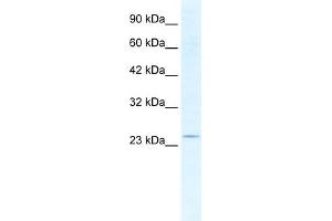 WB Suggested Anti-SOX14 Antibody Titration:  2. (SOX14 antibody  (Middle Region))