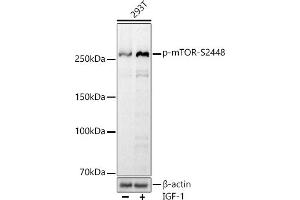 Western blot analysis of extracts of 293T cells, using Phospho-mTOR-S2448 antibody (ABIN7268435) at 1:1000 dilution. (MTOR antibody  (pSer2448))