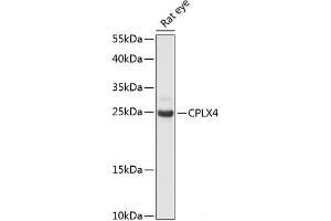 Western blot analysis of extracts of Rat eye using CPLX4 Polyclonal Antibody at dilution of 1:3000. (Complexin 4 antibody)