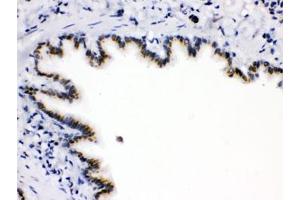 IHC testing of FFPE rat lung with ARSA antibody. (Arylsulfatase A antibody)