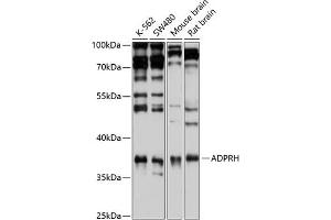 Western blot analysis of extracts of various cell lines, using ADPRH antibody (ABIN6129880, ABIN6136587, ABIN6136588 and ABIN6221872) at 1:1000 dilution. (ADPRH antibody  (AA 180-270))