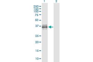 Western Blot analysis of IGFBP3 expression in transfected 293T cell line by IGFBP3 monoclonal antibody (M02), clone 2G6. (IGFBP3 antibody  (AA 182-291))