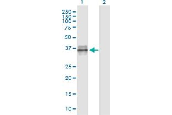 IGFBP3 antibody  (AA 182-291)
