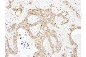 Immunohistochemistry (IHC) image for anti-Leucyl-tRNA Synthetase (LARS) (AA 250-300) antibody (ABIN7454577)