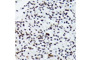 Immunohistochemistry (IHC) image for anti-Ribosomal Protein S6 Kinase, 70kDa, Polypeptide 1 (RPS6KB1) (pSer424), (pThr421) antibody (ABIN6136296)