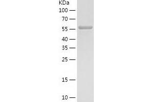 Western Blotting (WB) image for phosphoglycerate Dehydrogenase (PHGDH) (AA 1-533) protein (His tag) (ABIN7124414) (PHGDH Protein (AA 1-533) (His tag))