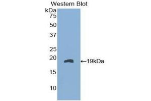 Detection of Recombinant FABP9, Mouse using Polyclonal Antibody to Fatty Acid Binding Protein 9, Testis (FABP9) (FABP9 antibody  (AA 1-132))