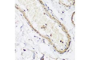 Immunohistochemistry of paraffin-embedded human colon using CAV3 antibody at dilution of 1:200 (40x lens).