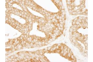 Immunohistochemistry (IHC) image for anti-Epidermal Growth Factor Receptor Pathway Substrate 15 (EPS15) (AA 575-625) antibody (ABIN7453701)