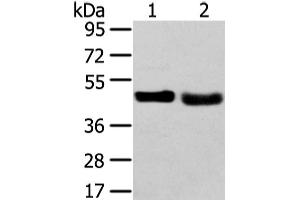 Western Blot analysis of 231 cell and Human fetal liver tissue using TRIB2 Polyclonal Antibody at dilution of 1/450 (TRIB2 antibody)