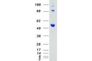 Western Blotting (WB) image for V-Akt Murine Thymoma Viral Oncogene Homolog 3 (Protein Kinase B, Gamma) (AKT3) (Transcript Variant 1) (Active) protein (Myc-DYKDDDDK Tag) (ABIN2714520)