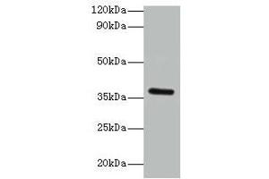 Western blot All lanes: BRCC3 antibody at 2 μg/mL + K562 whole cell lysate Secondary Goat polyclonal to rabbit IgG at 1/15000 dilution Predicted band size: 37, 34, 24, 29 kDa Observed band size: 37 kDa (BRCC3 antibody  (AA 14-316))
